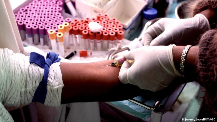 Panamá es el país con más contagios nuevos de VIH en América Central